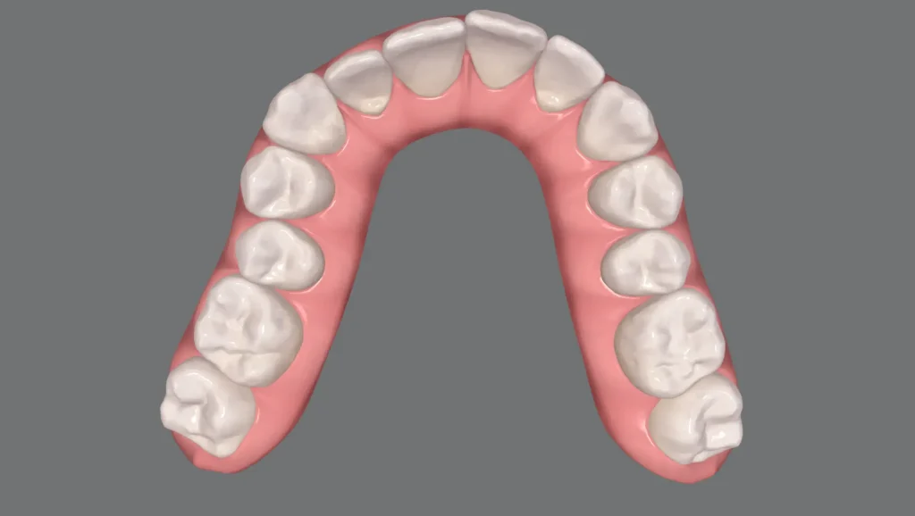 Ortodoncia antes y después desalineación